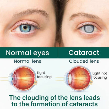 Ceoerty OptiClear Nano Eye Roller Serum