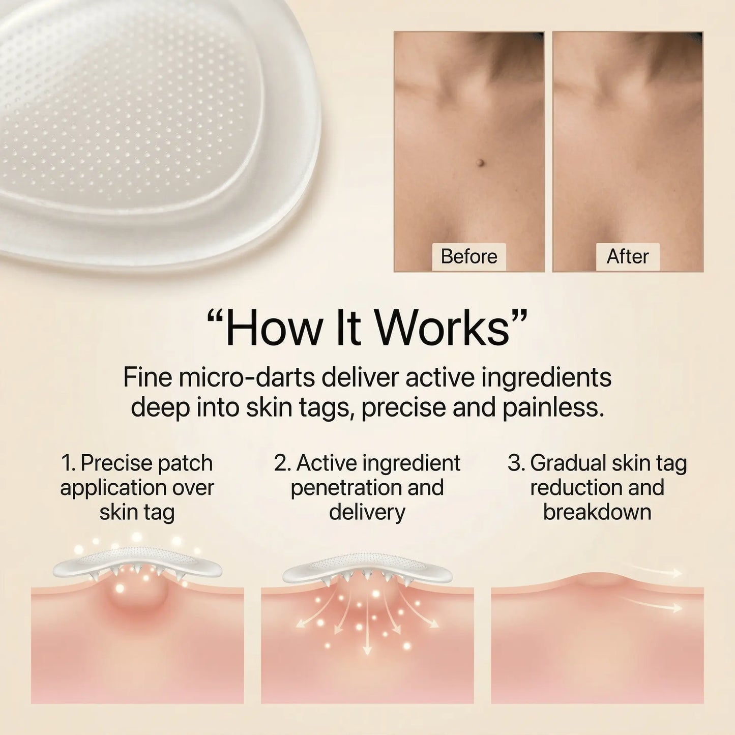 DermaSmooth - Tag & Mole Remover (Copy)