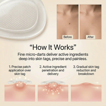 DermaSmooth - Tag and Mole Remover